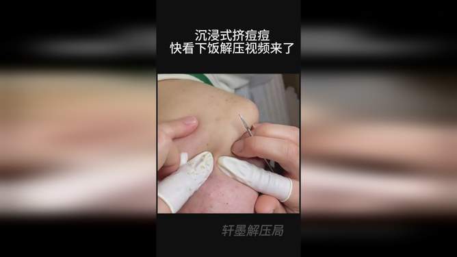 探究挤脓包视频背后的真相与警示，揭露真相，警醒大众