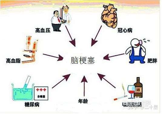 脑梗最新治疗方法，探索创新，点燃希望之光